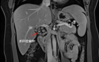 微信截图_20250915125817.png 微信截图_20250915125817.png