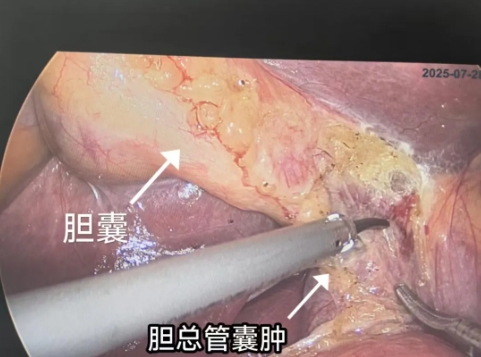 微信截图_20250915125827.png 微信截图_20250915125827.png